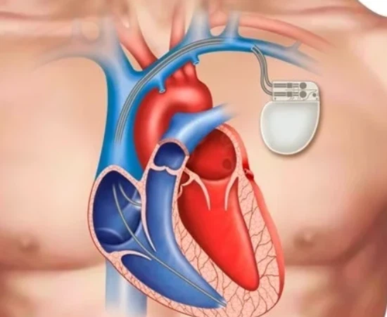 Medical Devices Medical Devices